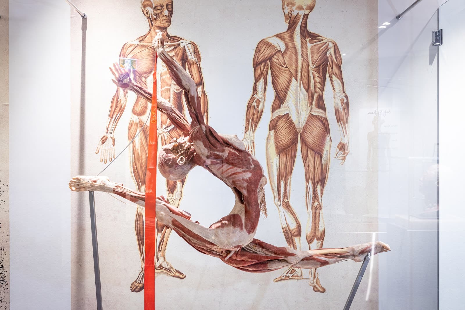 The Real Human Anatomy Exhibition — Palm Beach, Gold Coast