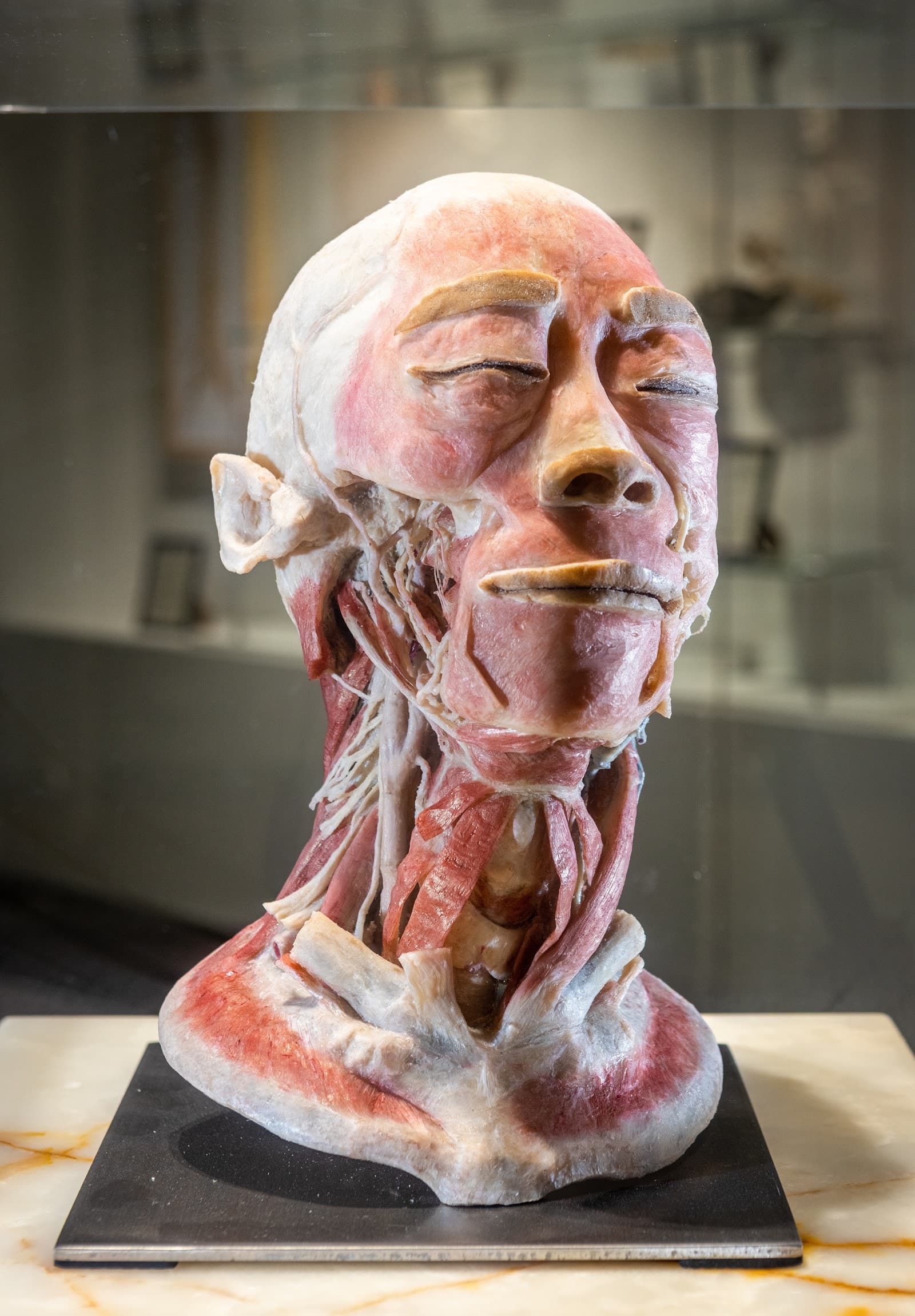 The Real Human Anatomy Exhibition — Palm Beach, Gold Coast