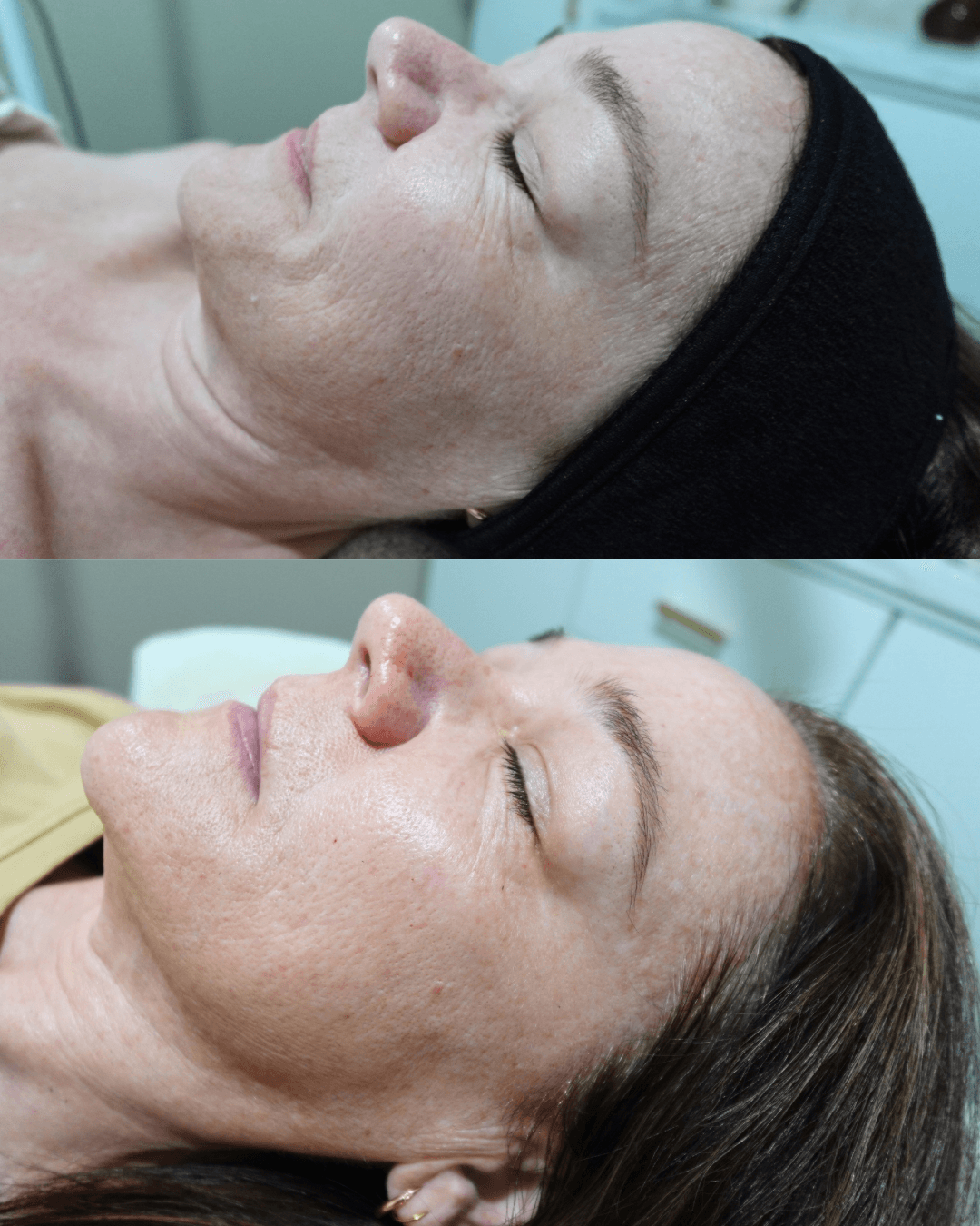 ZAYA Skin and Wellness — Mermaid Beach, Gold Coast